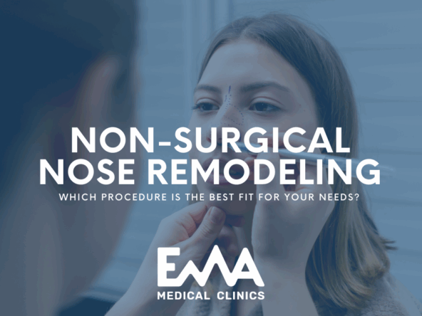 Woman with facial markings looking into a mirror, being assessed for non-surgical nose remodeling, with text overlay: 'Non-Surgical Nose Remodeling – Which procedure is the best fit for your needs? – EMA Medical Clinics