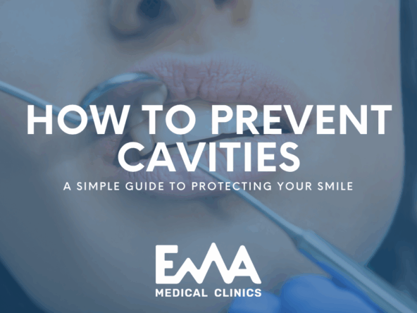 Close-up of a dental checkup with tools near a patient’s mouth, illustrating a blog about how to prevent cavities. Text overlay reads "How to Prevent Cavities – A Simple Guide to Protecting Your Smile" from EMA Medical Clinics.